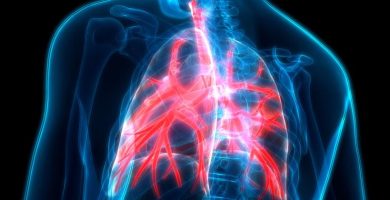 Bronquitis Aguda en Adultos
