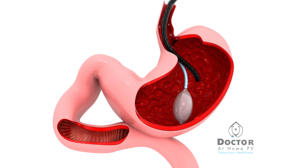 endoscopia puerto vallarta